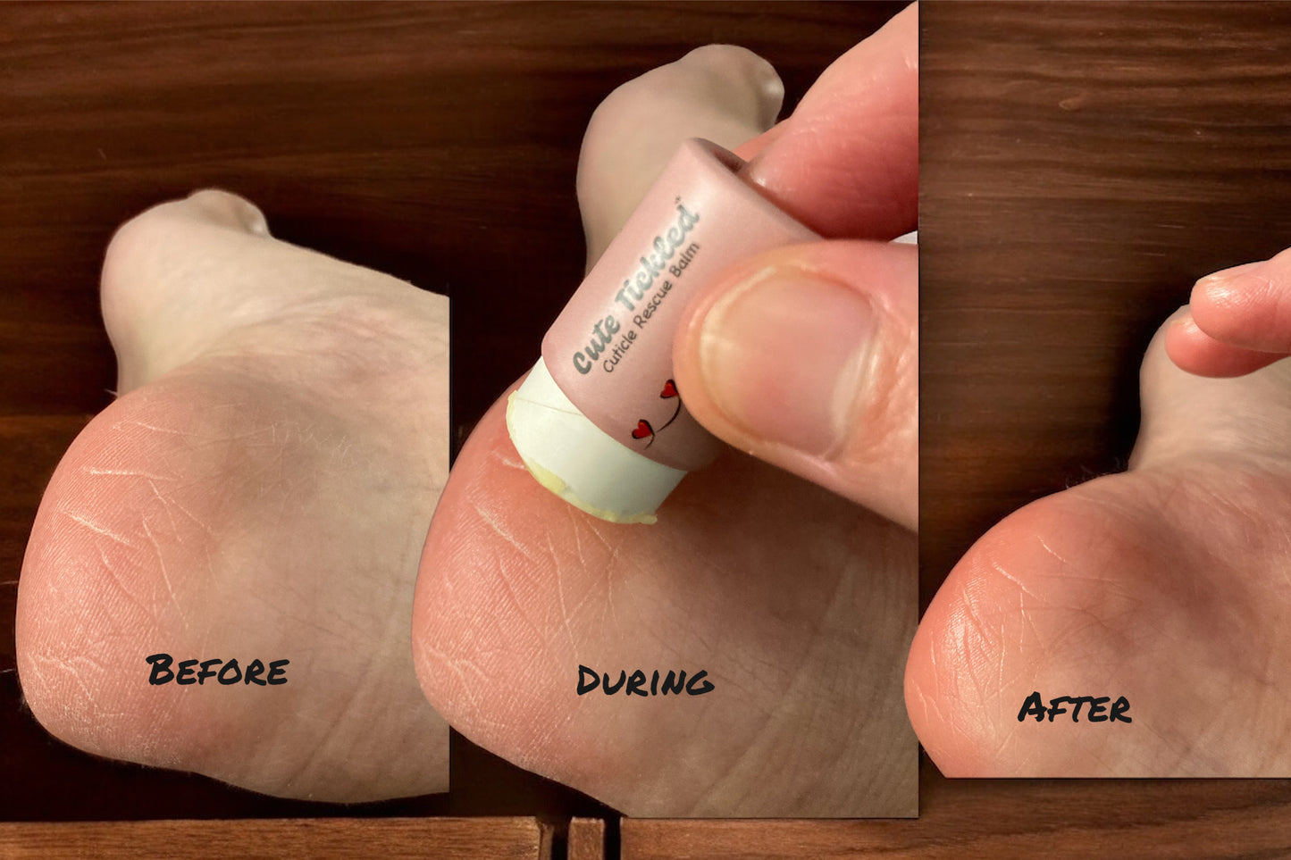 Cuticle rescue balm - Tea tree Oil